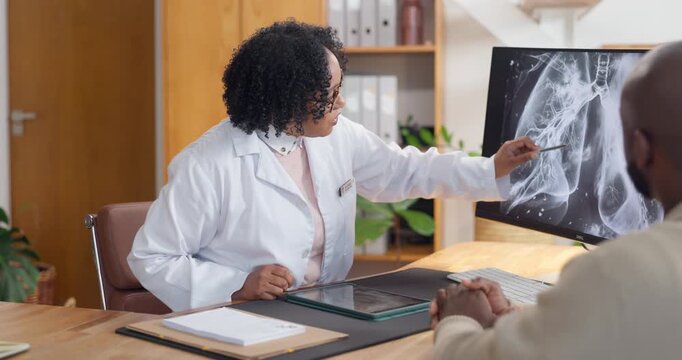 Medical, computer screen or people with x ray, lung mri result or discussion in hospital review. Health, patient or radiologist with tech, diagnostic feedback or respiratory scan for treatment plan.