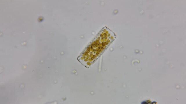 Diatom microscopic view under optical microscope showing silica frustule and golden chloroplasts