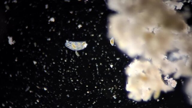 Ciliate protozoa feeding on diatoms microalgae under darkfield microscopy 