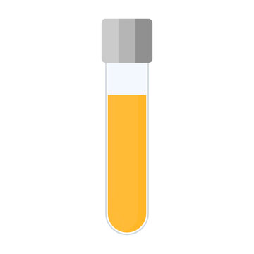 Urine sample tube with a lid for kidney exam, urinary tract infection and cystitis diagnostics. Ketone and PH rapid test for ketogenic and alkaline diets. Medical vector illustration.