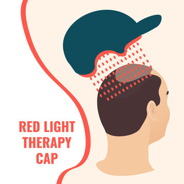 Red light therapy cap on male head profile with glowing scalp diodes vector illustration.