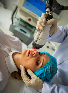 Laser Facial Rejuvenation Treatment.