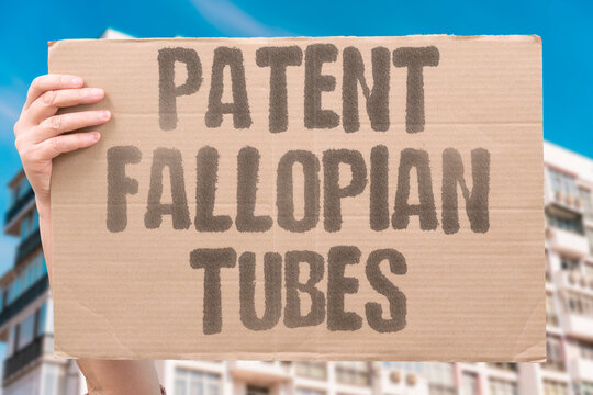 "Patent fallopian tubes" Patent fallopian tubes with infertility cause. PATENT. TUBES. NORMAL. INFERTILITY. IDIOPATHIC.