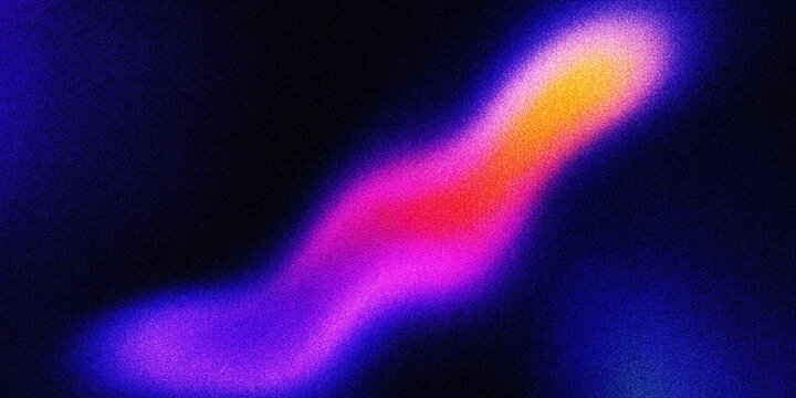 Medical scintigraphy scan showing radioactive tracer uptake in human organ diagnostic imaging.