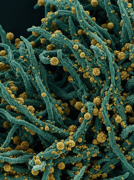 Microscopic View of Fungal Filaments and Spores