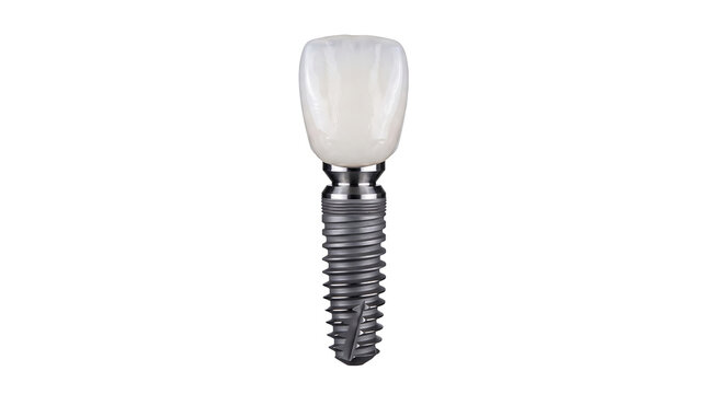 Professional dental implant and ceramic crown for dental care props