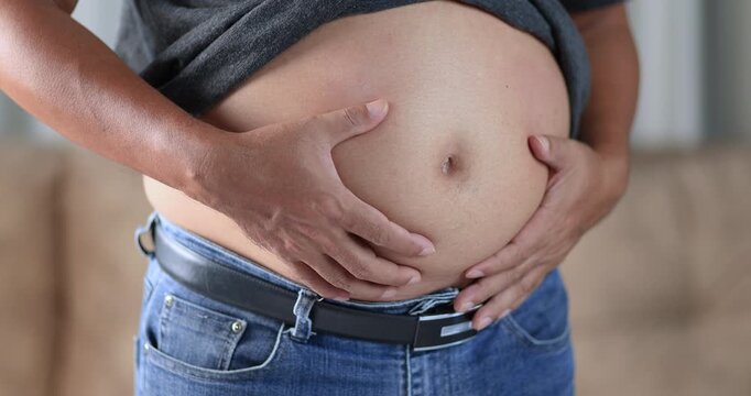 Overweight man holding his belly, obesity, belly fat, excess weight, visceral fat, unhealthy lifestyle, weight loss, metabolic health, and healthcare concept, close-up