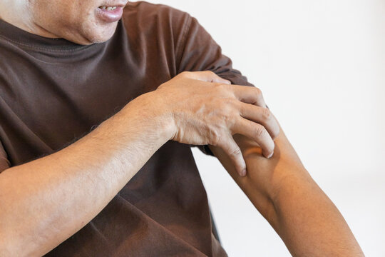 hand of asian senior man scratching his itchy arm from a mosquito bite or skin rash at home, allergic reaction concept indoor scene