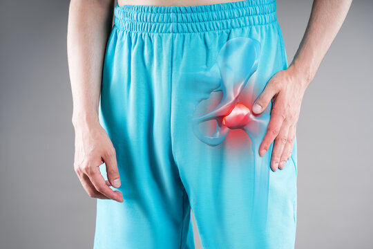 Hip dysplasia, joint inflammation, man suffering from pain, pelvic osteoarthritis, painful area in red with illustration anatomical skeleton