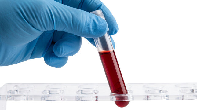 Medical blood sample in glass test tube, gloved hand holding laboratory vial, clinical hematology testing on white background