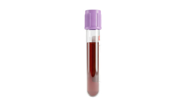 Sterile lavender top blood collection vial used for hematology testing and laboratory assays.