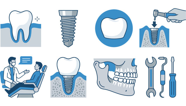Set of dental implant procedure icons and medical tooth illustrations