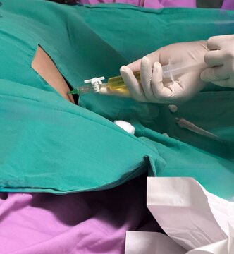 abdominal paracentesis