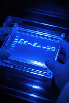 Scientist wearing blue gloves holding a transparent gel box with glowing blue DNA bands, analyzing results on a transilluminator under ultraviolet lighting in a laboratory