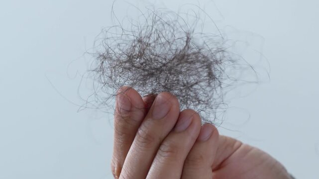 young woman her hair and have many hair loss. problem of maintenance losing by sad strain cancer patients after receiving chemotherapy. Healthcare and medical concept.	
