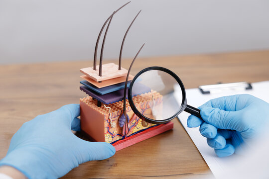 Closeup Skin model displayed on desk with doctor trichologist in laboratory