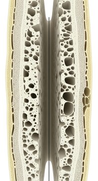 Osseous health degradation: firm structure, fragile matrix, density decrease, progressive osteoporosis, tissue damage, mineral depletion, skeletal frailty, internal erosion.