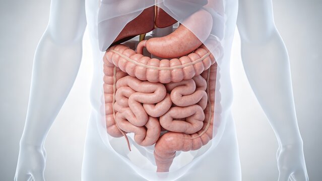 Colorectal Cancer: Malignant Tumor Lesion of Human Colon Rectum, 3D Medical Anatomical Illustration of Large Intestine