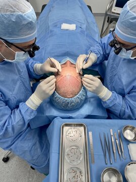 Medical team performing professional hair transplant surgery on a patient