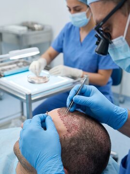 Professional hair transplant surgery procedure on a male patient