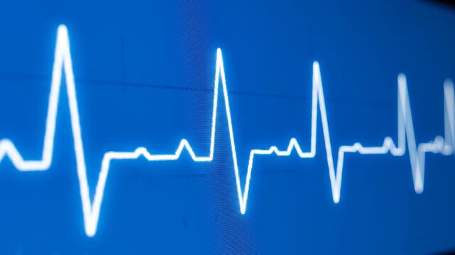 ECG heart rhythm pulsing on blue screen with black background during medical examination