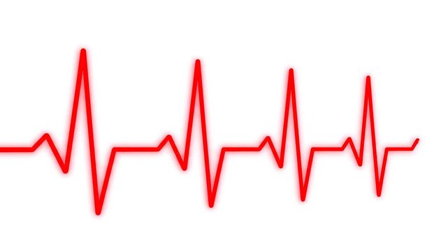 EKG Heartbeat Rhythm Progression with Clean White Background and Subtle Motion