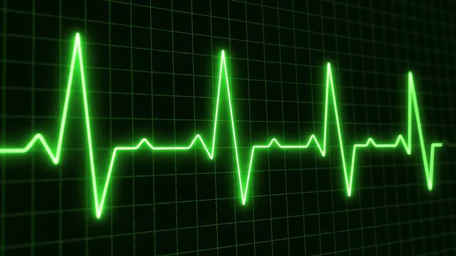 Ekg waveform pulsing with steady rhythm on a dark background during a medical examination