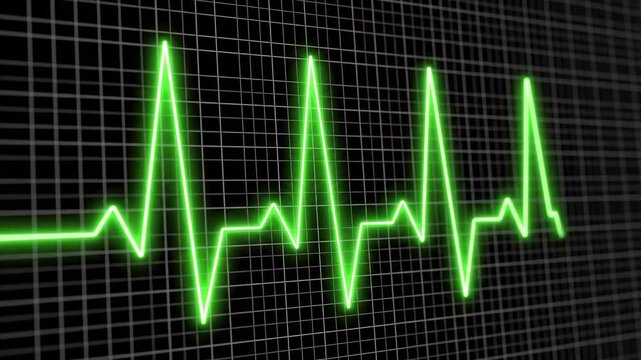 Electrocardiogram waveform evolving from flatline to irregular rhythm on digital grid