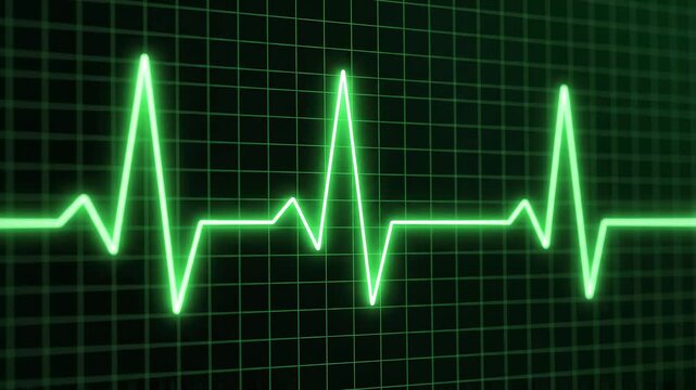 Electrocardiogram waveform on green digital grid during medical monitoring with cinematic motion