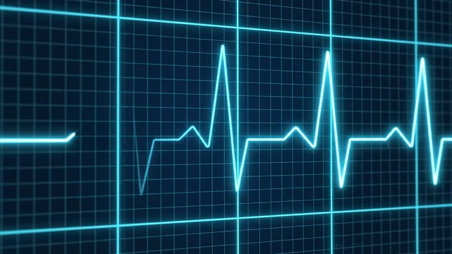 Electrocardiogram waveform rising on a digital blue grid with cinematic motion and subtle focus shift