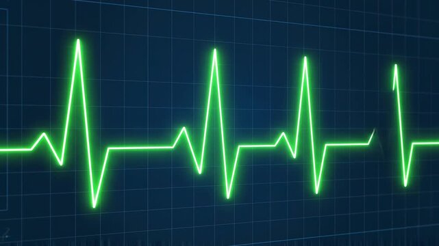 Green ECG wave pulses on a dark blue monitor screen with smooth camera zoom out