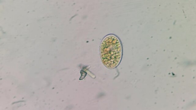 Microscopic view of Frontonia leucas ciliate with endosymbiotic Chlorella algae, light microscopy