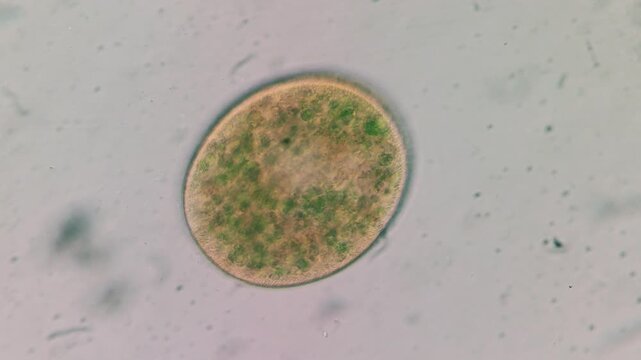 Microscopic view of Frontonia leucas ciliate with endosymbiotic Chlorella algae, light microscopy
