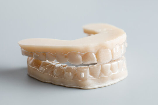3D Printed Dental Aligners and Jaw Model
