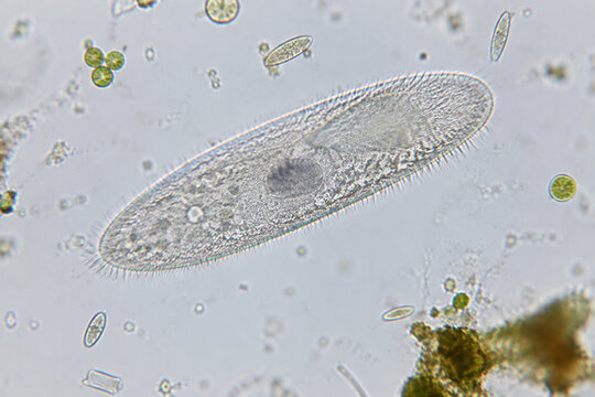 Protozoan with cilia in water sample, microbiology concept