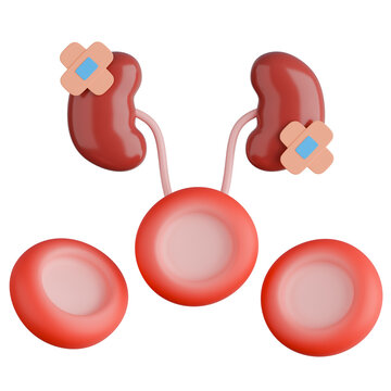 3D rendering of hypochromic red blood cells and injured kidneys with bandages depicting anemia of chronic disease.