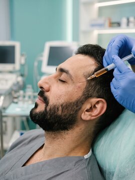 A bearded man receives a PRP injection into his scalp hairline from a gloved specialist, a hair restoration and hair growth treatment concept.