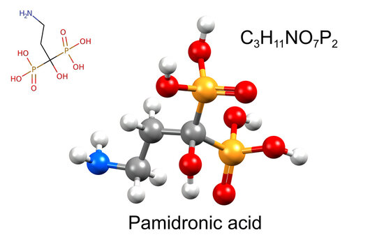 Structure of pamidronic acid, a medicine for osteoporosis. Chemical formula, structural formula, and 3D ball-and-stick model