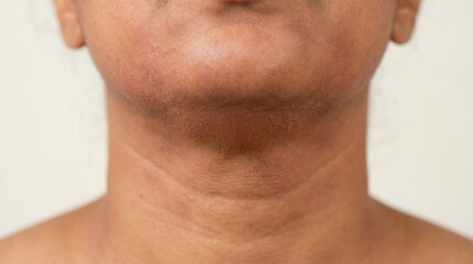 Naklejka premium Close up of a man with a visible surgical scar on his neck