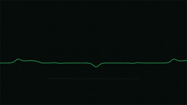Green digital heartbeat line on dark background representing medical monitoring technology for healthcare and critical patient care status