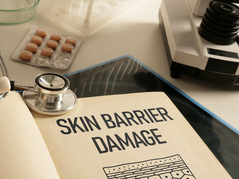 Skin Barrier Damage Concept, Impaired Protective Function of the Epidermis Causing Dryness, Irritation, Sensitivity, Moisture Loss, Inflammation and Need for Skin Barrier Repair