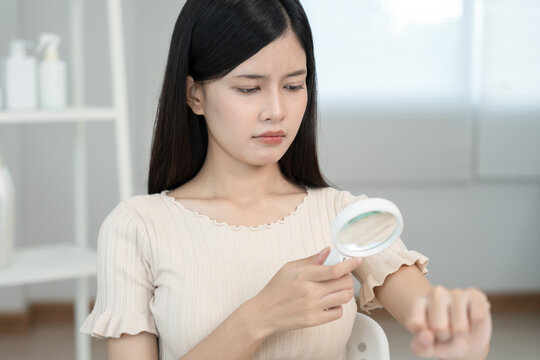 skin problem and beauty. asian woman use magnifying glass look itchy skin from skin allergic, shocked, steroid allergy, sensitive, chemical allergy, rash, insect bites, Seborrheic Dermatitis.