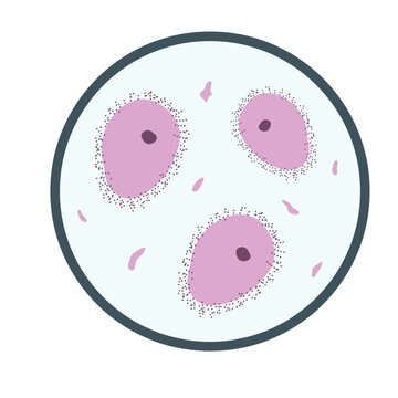 Gardnerella Vaginalis Bacterial Vaginosis Microscopic Illustration
