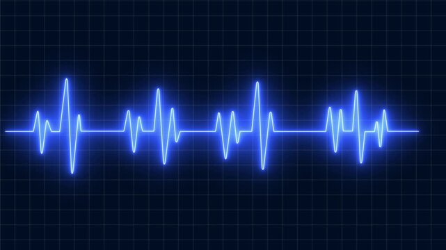 Broken heart syndrome concept ,Electrocardiogram heartbeat pulse monitor glowing blue light dark grid background showing vital. 4K video