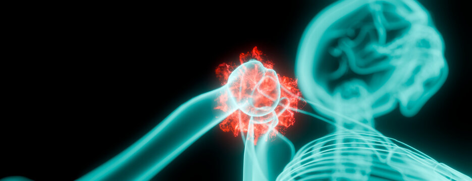 Abstract representation of shoulder joint pain and inflammation