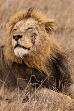 View of a male lion with a visible injury on its face, resting in dry grass in South Africa.