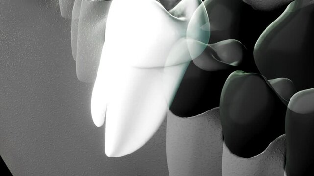 Dental 3D Animation Illustrating Infection Around Teeth and Gum Tissue