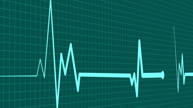 Health heartbeat line medical ekg rhythm pattern health monitor signal and heart activity chart animation