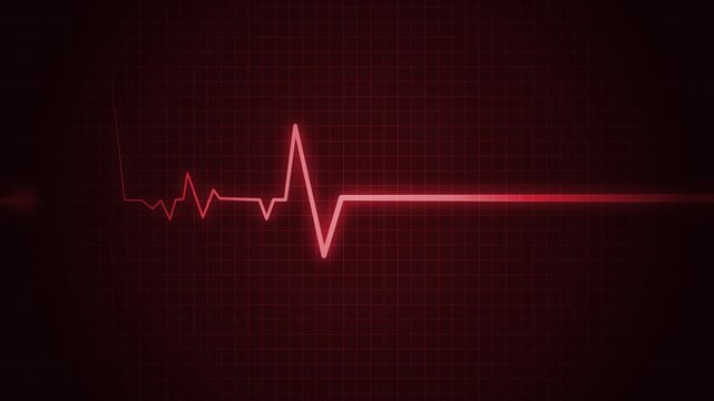 Heart beat line on graph paper showing an ecg pattern and medical signal animation
