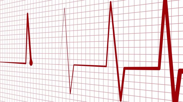 Ecg heart rhythm line on graph paper showing pulse spikes and flat line animation